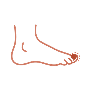 We treat Arterial Ulcers