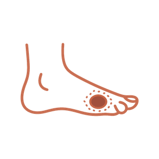 We treat Diabetic Ulcers and other diabetic wounds