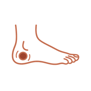 We treat Pressure Ulcers