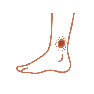We treat venous ulcers