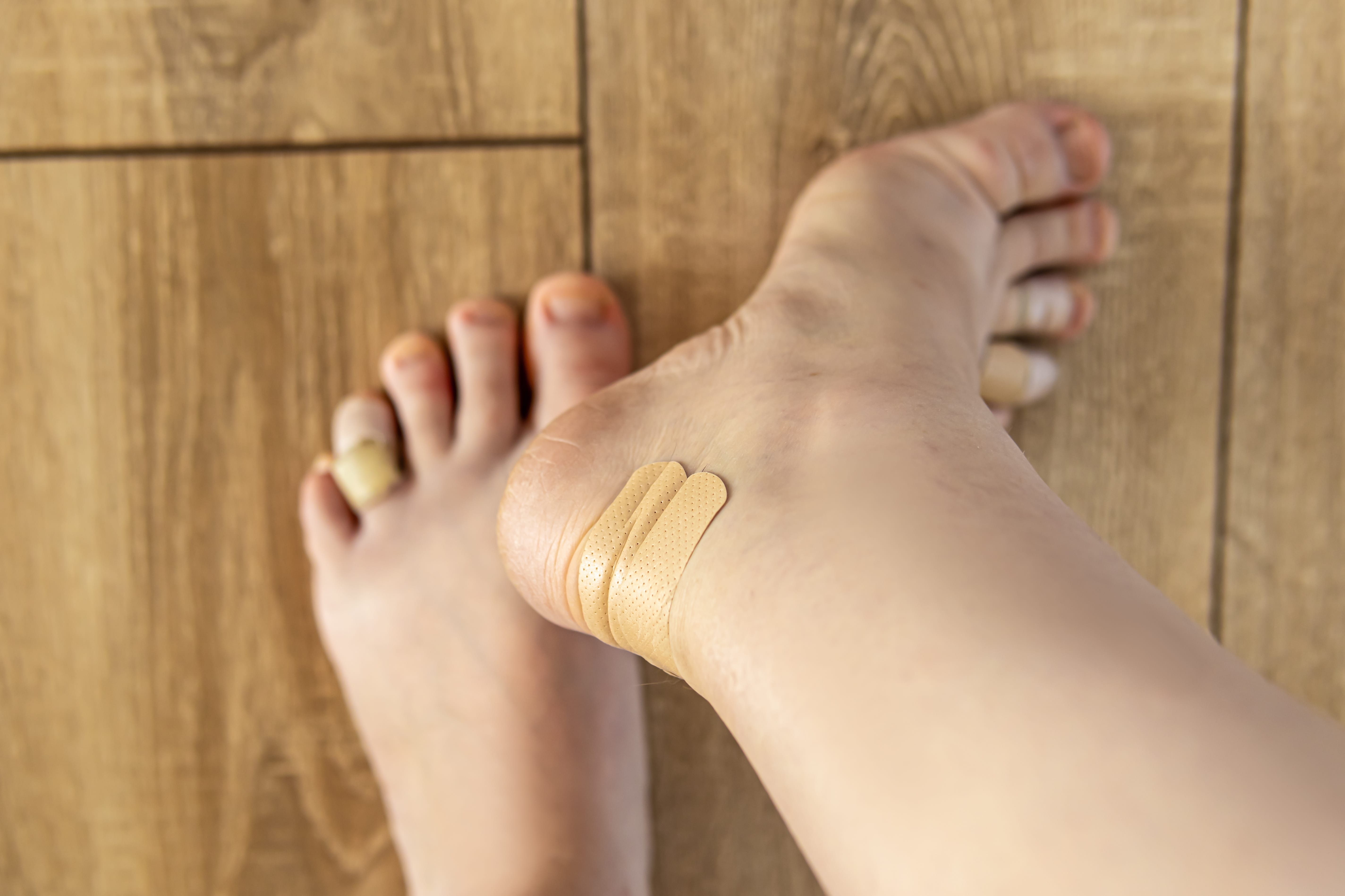 Foot wrapped in bandage. A first aid procedure with bandages and aid provided to injuries and damage. Care of injured persons in accidents.