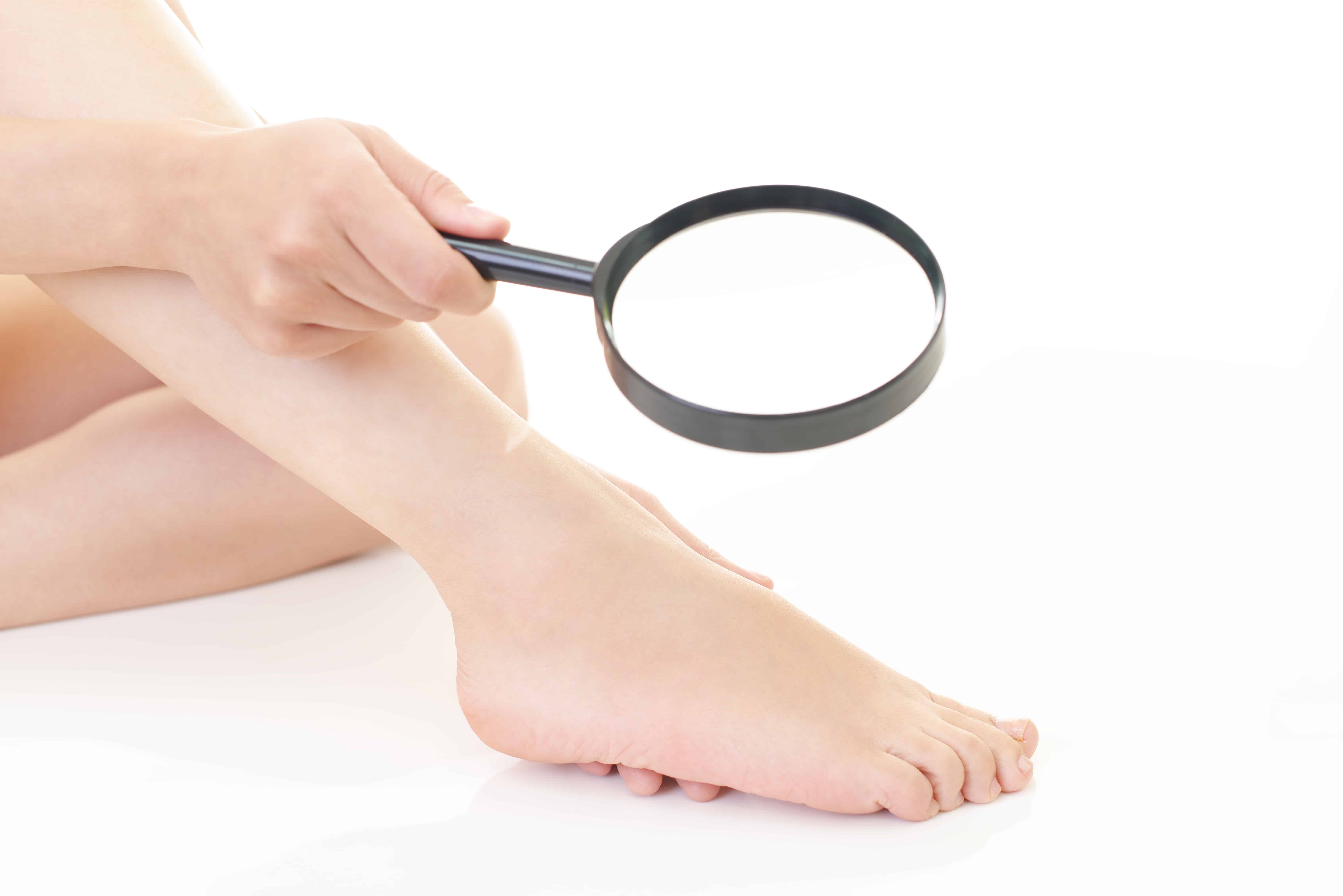 Woman searching for wounds on her foot with a magnifying glass