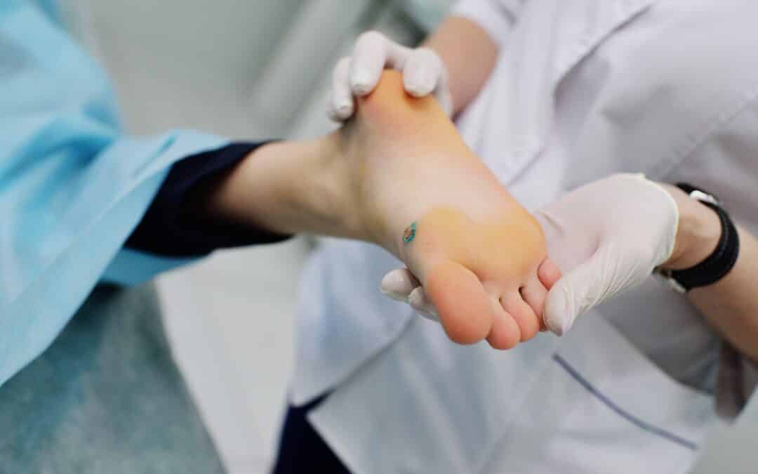 Understanding the Different Types of Ulcers: Arterial, Diabetic, Pressure, and Venous