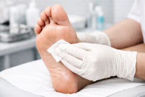 Professional podiatrist in protective gloves cleaning a human foot with a cotton pad, performing a medical procedure for foot care, health, and hygiene in a medical office setting