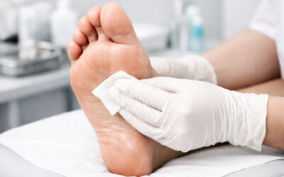 Chronic Wounds: Causes, Treatment & Care in Central PA