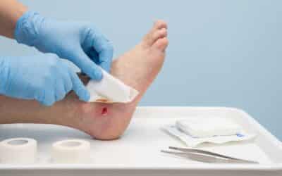When Should You Get a Second Opinion for a Non-Healing Wound?